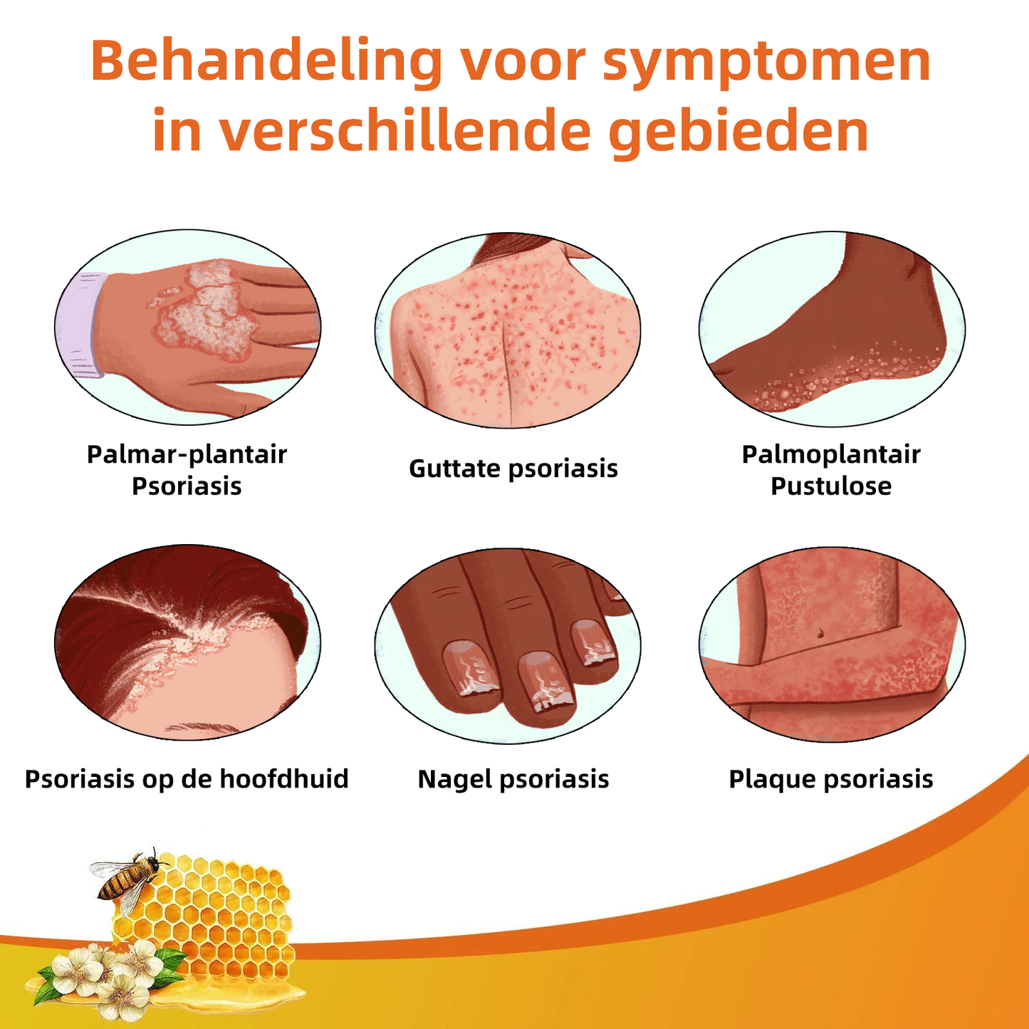 🌈Cvreoz Bijengif Psoriasis Behandelingscreme (👨‍⚕AAD Aanbevolen)🐝🐝